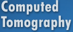Computed Tomography  - Midlands Musculoskeletal Imaging